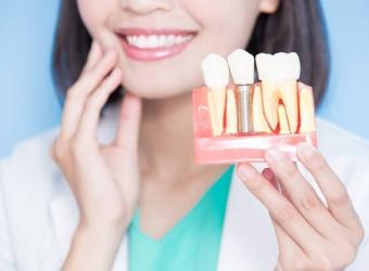 Are Dental Implants Stronger Than Your Teeth